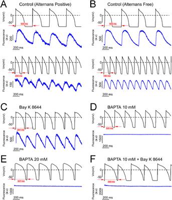 The calcium transient coupled to the L-type calcium current attenuates cardiac alternans